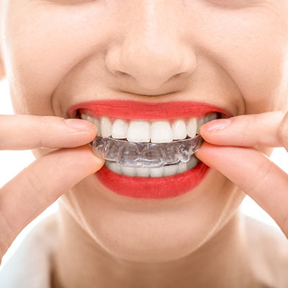 orthodontic retention